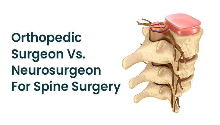 Orthopedic Surgeon Vs. Neurosurgeon For Spine Surgery